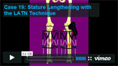 Image - thumbnail of Case 19: Stature Lengthening with the LATN Technique video.