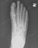 What's the Diagnosis? Case 9