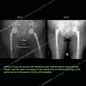 Image - What's the Diagnosis Case 141 thumbnail