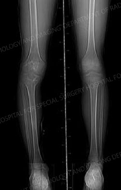 X-ray mage following post-surgery