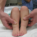 Image of a doctor holding an infants legs