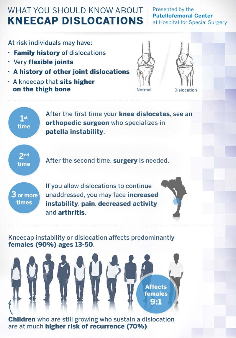 Kneecap dislocations infographic