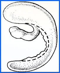 Illustration showing tear and area of resection.