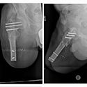 Case 4 x-ray thumbnail