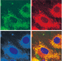 Imaging agents in nanoparticles show early signs of osteolysis.