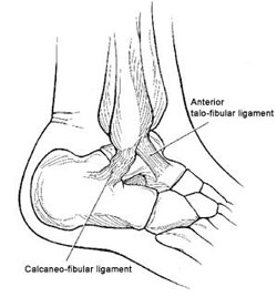 Line drawing of the anatomy of the lateral or outer ankle with the two major ligaments