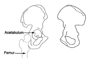 Anatomical illustration of the acetabulum from an article about Pelvic Fractures/Acetabular Fractures