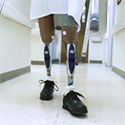Image: Prosthetics and Orthotics