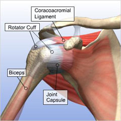 Image showing rotator cuff anatomy, labeled clockwise to identify: rotator cuff, coracoacromial ligament, joint capsule (of the shoulder), biceps tendon