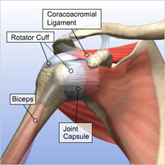 How to Fix a Torn Shoulder Strap, Lollipuff