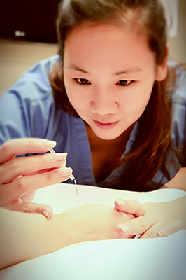 Dr. Stephanie Cheng performs acupuncture on a patient.