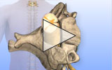 Cervical spine herniated disc animation