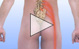 Thumbnail image of a sciatica animation