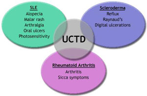 Illustration of overlapping features from different diseases resulting in UCTD diagnosis