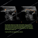 Image - Ultrasound Case 100 thumbnail