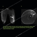 Image - Ultrasound Case 102 thumbnail