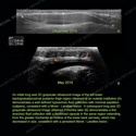Image - Ultrasound Case 103 thumbnail