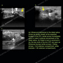 Image - Ultrasound Case 104 thumbnail
