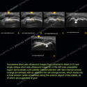 Image - Ultrasound Case 109 thumbnail