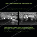 Image - Ultrasound Case 112 thumbnail
