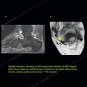 Image - Ultrasound of the Month Case 77 thumbnail
