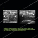 Image - Ultrasound of the Month Case 78 thumbnail