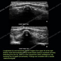 Image - Ultrasound of the Month Case 79 thumbnail