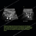 Image - Ultrasound of the Month Case 80 thumbnail