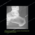Image - Ultrasound of the Month Case 81 thumbnail