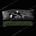 Image - Ultrasound of the Month Case 86 thumbnail