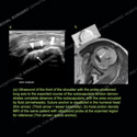 Image - Ultrasound of the Month Case 89 thumbnail