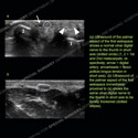 Image - Ultrasound Case 99 thumbnail