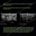 Image - Ultrasound Case 116 thumbnail