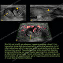 Image - Ultrasound Case 106 thumbnail