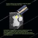 Image - Ultrasound Case 115 thumbnail