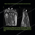 Image - Ultrasound Case 117 thumbnail