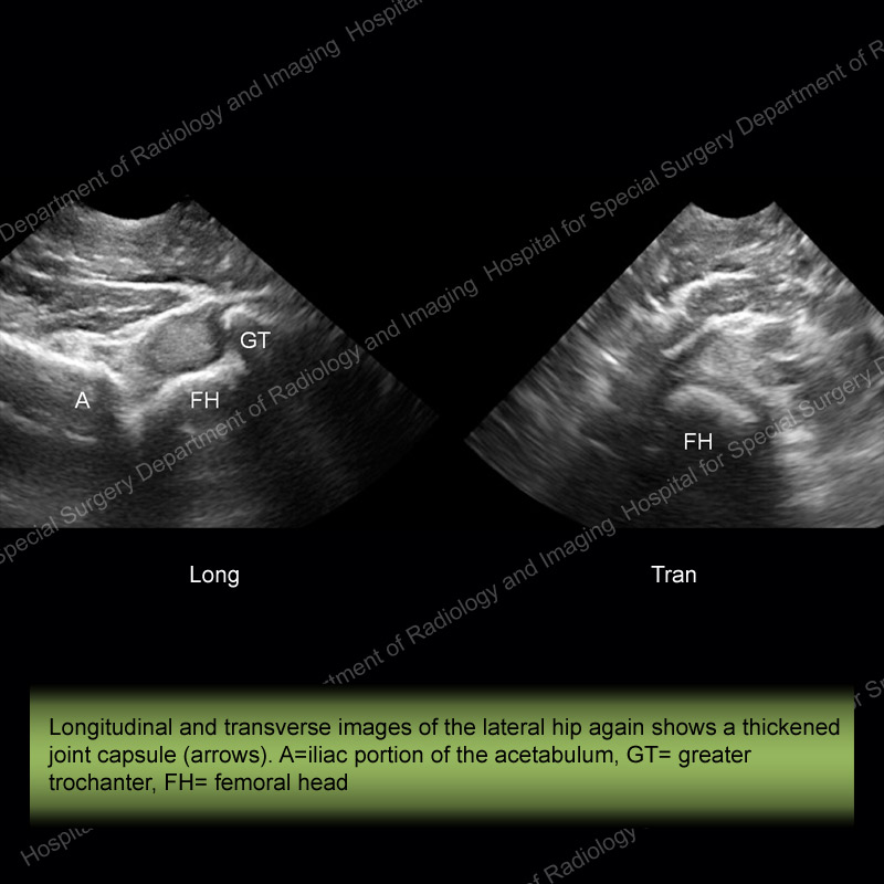 Ultrasound of the Month Case 10 - slide 2