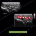Image - Ultrasound of the Month Case 11 thumbnail
