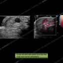 Image - Ultrasound of the Month Case 12 thumbnail