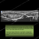 Image - Ultrasound of the Month Case 14 thumbnail
