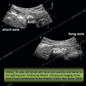 Image - Ultrasound of the Month Case 19 thumbnail