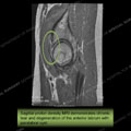 Image - Ultrasound of the Month Case 20 thumbnail