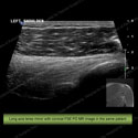Image - Ultrasound of the Month Case 4 thumbnail