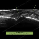 Image - Ultrasound of the Month Case 1 thumbnail
