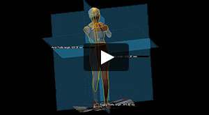 Video: Revolutionizing Scoliosis Imaging Without Ionizing Radiation
