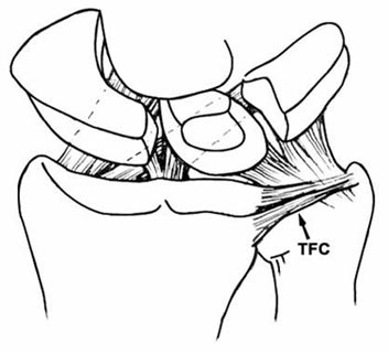 Illustration of triangular fibrocartilage