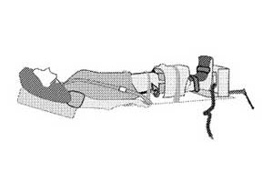 System for Securing a Knee Joint with a Load for MRI
