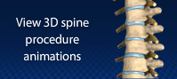 View 3D spine procedure animations