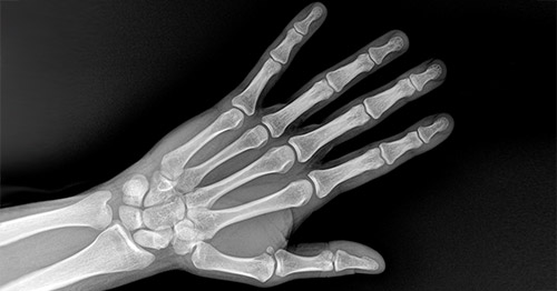 X-ray image of the hand and wrist.