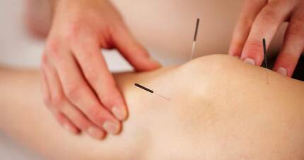 Image - Acupuncture and Surgery: A “New” Tool for Relief